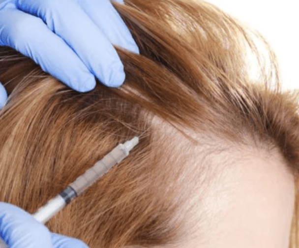 PRP Hair Treatment Soluna London offers PRP hair treatment for all types of hair loss, thin hair and promoting hair growth after hair transplant. Book today