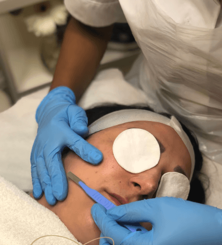 Dermaplaning Our dermaplaning facials gently buffs the top layer of dead skin cells away to reveal a brighter and smoother complexion and airbrushed finish. Call 0333 016 3500.