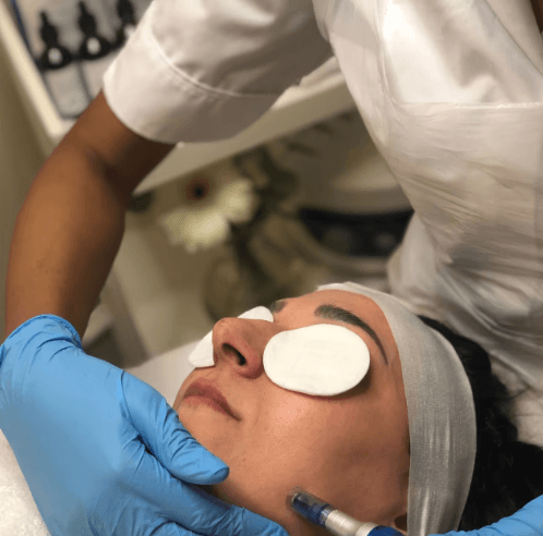 Microneedling Our microneedling facials treatment in London uses very tiny needles to stimulate a healing response. Our treatment is suitable for all skin types. Request a call back