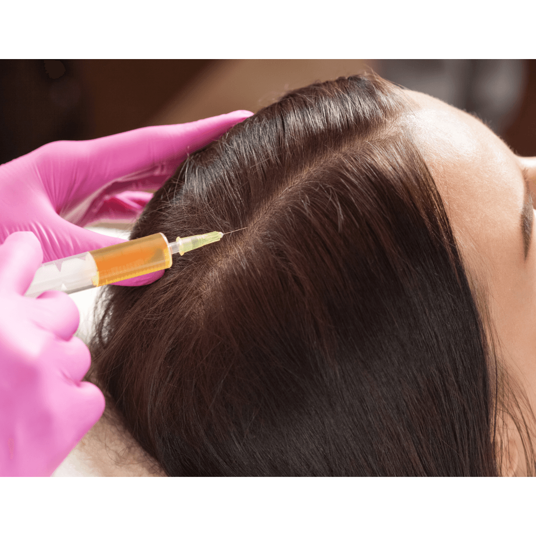 HAIR REJUVENATION PRP A natural and highly effective hair restoration treatment designed to combat hair loss, stimulate dormant hair follicles, and promote healthy, thicker hair growth. Ideal for those seeking to enhance hair density and improve scalp health naturally. Book today at 03330163500.