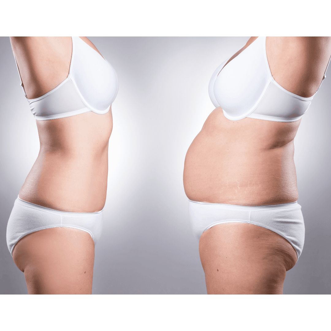 3D BODY SLIM Sculpt your body effortlessly with our 3D Bespoke Non-Surgical Fat Removal. Using advanced technology, this personalised, non-invasive treatment targets stubborn fat for a more defined, confident you. No surgery or downtime is required. Call 0333 016 3500.