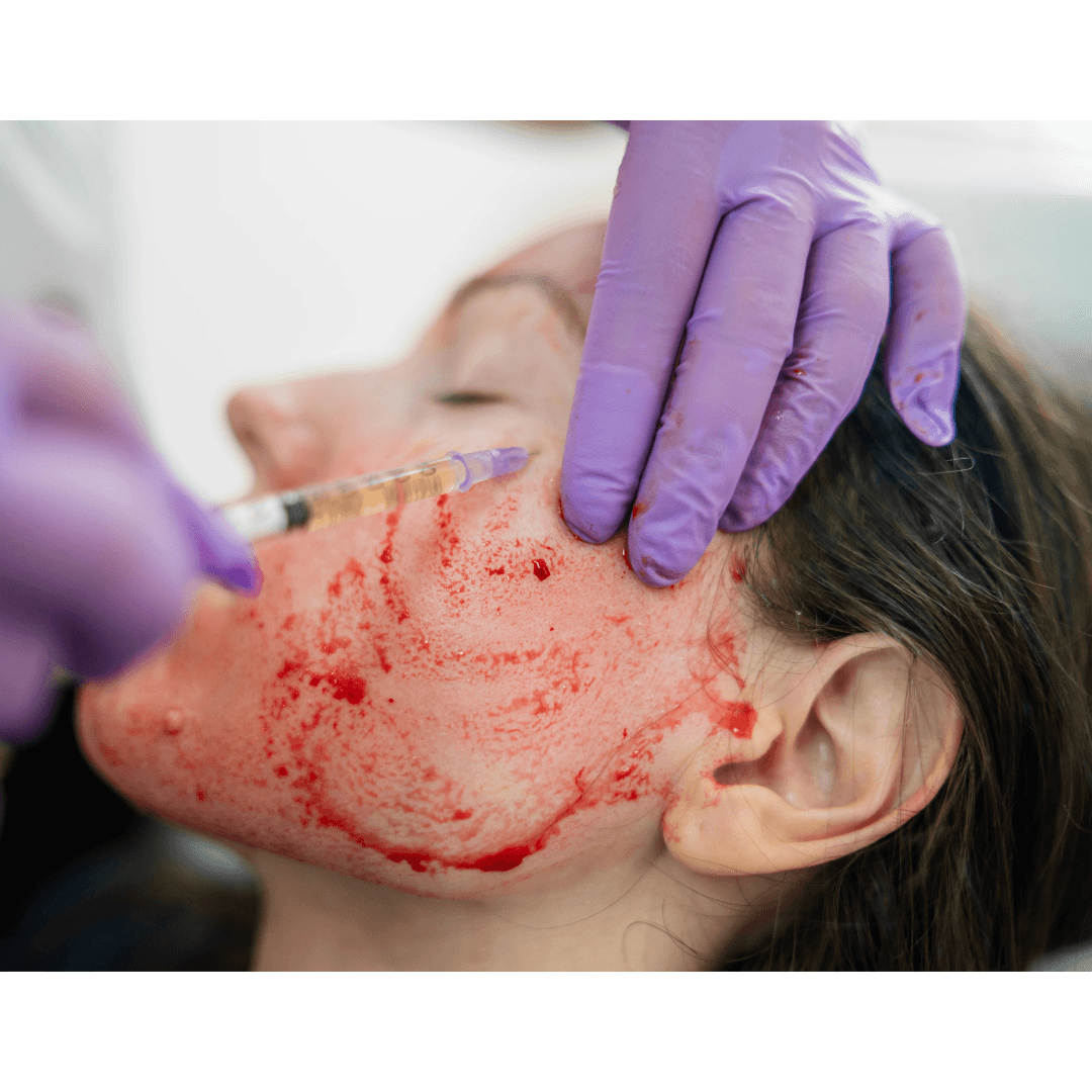 DRACULA SKIN THERAPY Discover the transformative power of Dracula Skin Therapy Facials! This revolutionary treatment revitalises your skin, leaving your face luminous, plump, and deeply hydrated. Call 0333 016 3500.