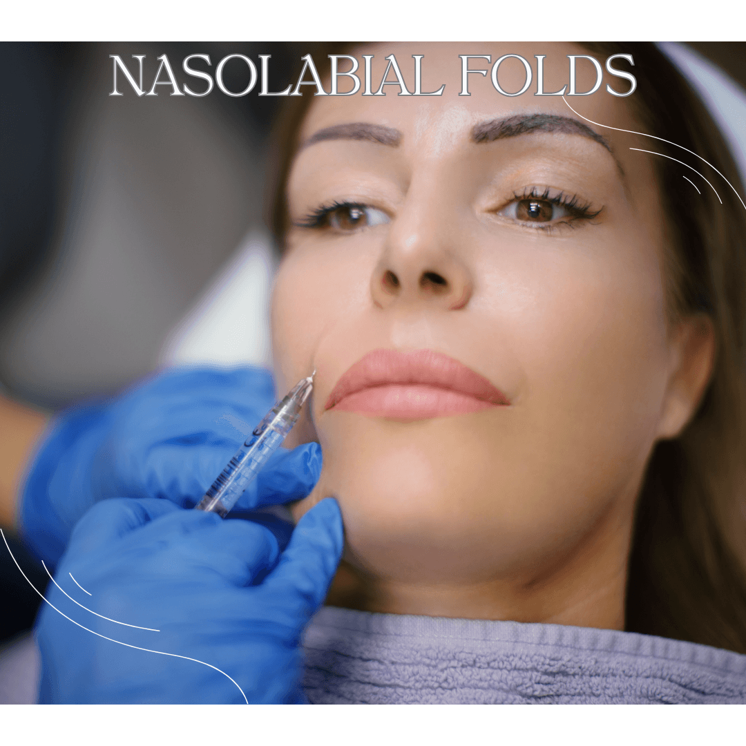 Smooth and rejuvenate your appearance with our targeted dermal filler treatment for nasolabial folds!