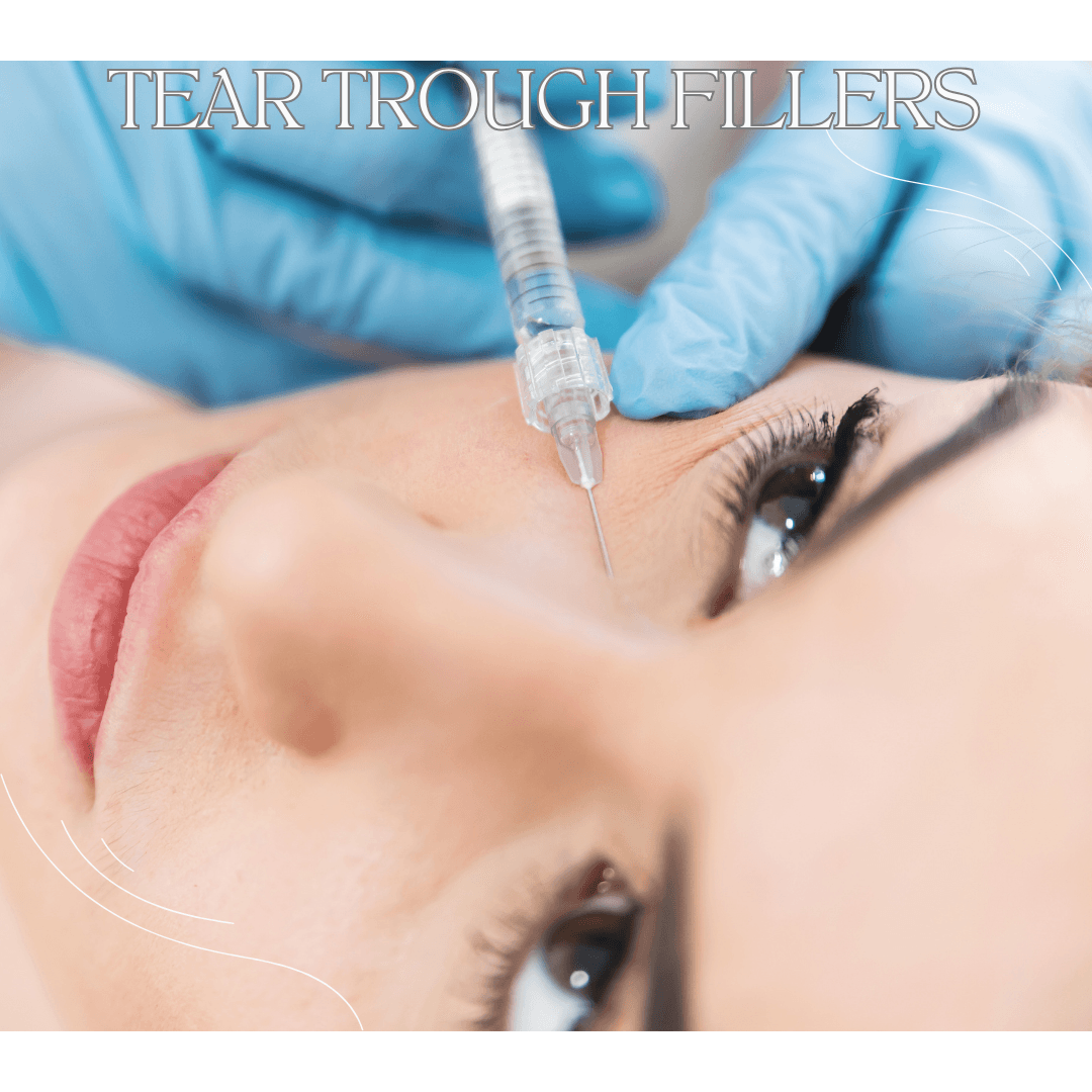 Refresh your look with Tear Trough Fillers, designed to smooth under-eye hollows and restore a youthful, vibrant appearance!