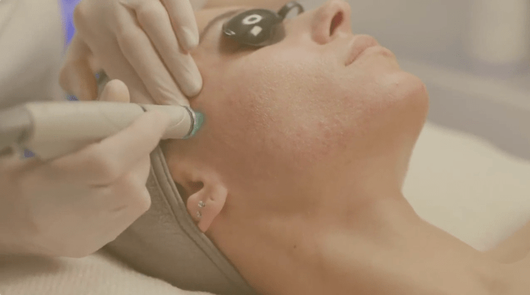 Watch our video to learn more about the treatments at Soluna London